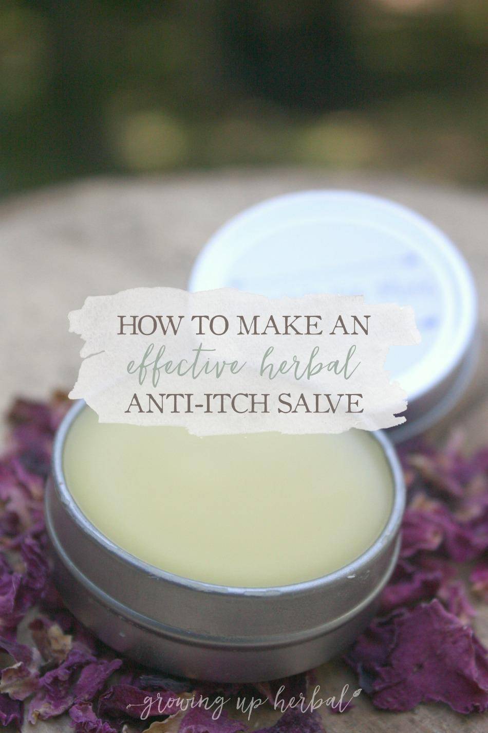 18 DIY Anti Itch Cream Recipes Image
