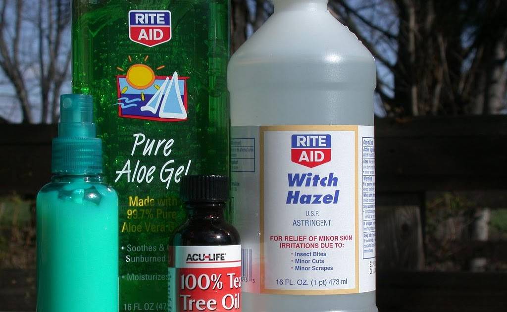 18 DIY Anti Itch Cream Recipes Image