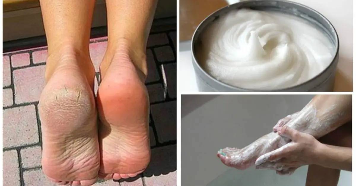 24 Baking Soda Foot Scrub Recipes Image