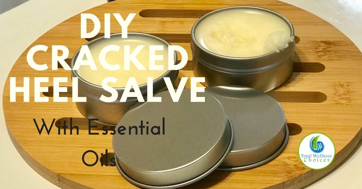 36 Essential Oil Salve Recipes Image
