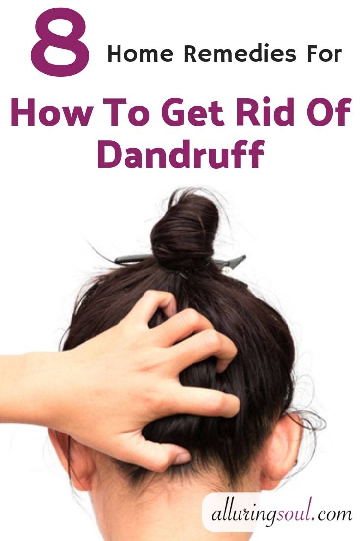 Natural Dandruff Solutions: 8 Home Remedies Image